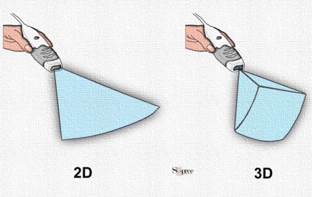 2D vs 3D